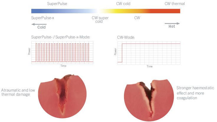 Brandneue und innovative Laserbetriebsarten