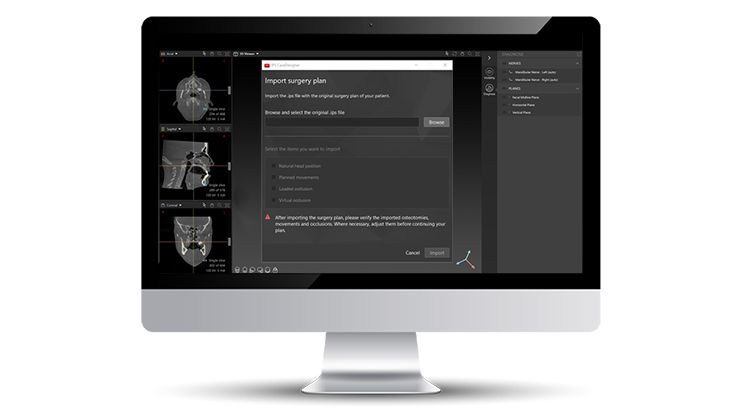 Import surgery plan