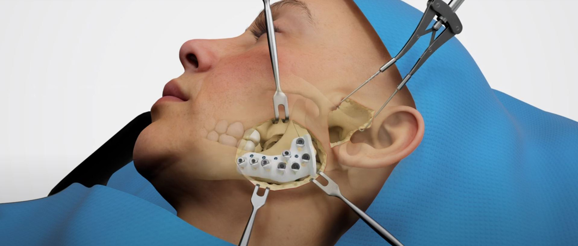 Individual Patient Solutions - IPS