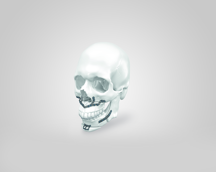 IPS Implants® Orthognathics