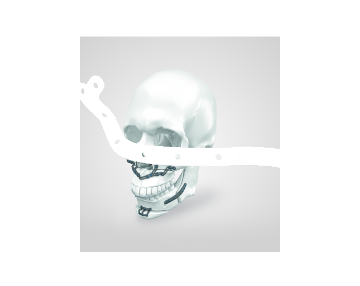 IPS Implants® Orthognathics