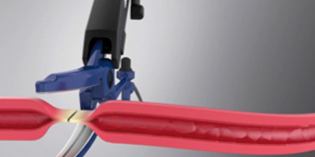 Sellado de vasos marClamp® Cut IQ 18 - Corte y separación del tejido