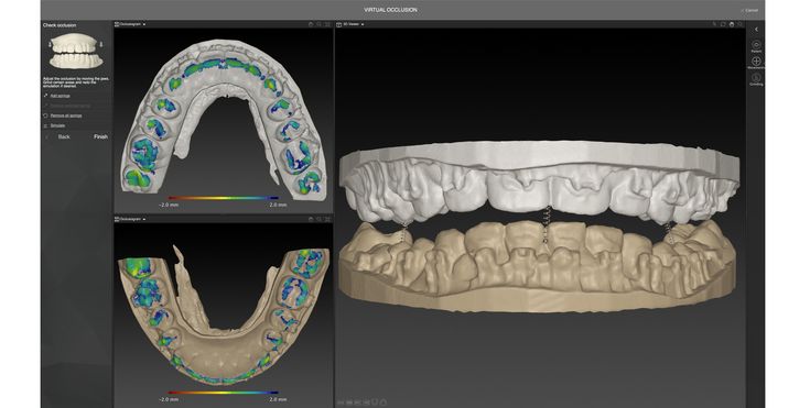 IPS CaseDesigner® - Función
