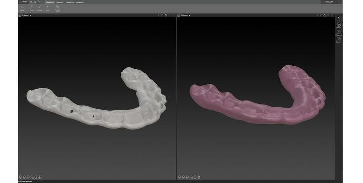 IPS CaseDesigner® - Transferencia