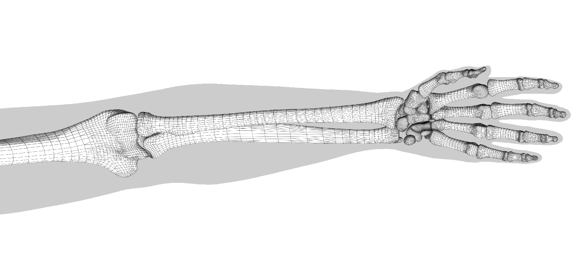 Individual Patient Solutions | Obere Extremitäten
