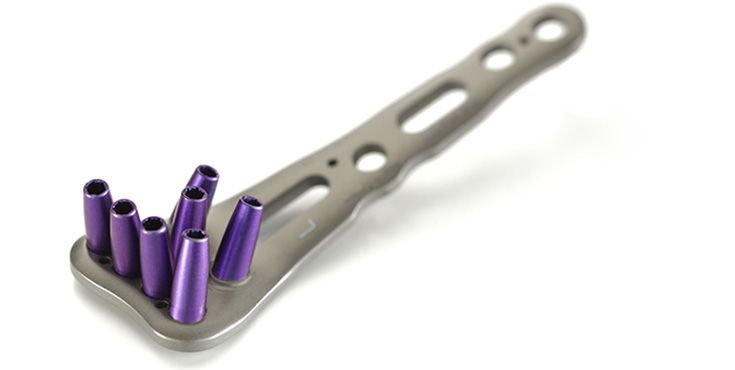 Handsurgery - Recos Radius