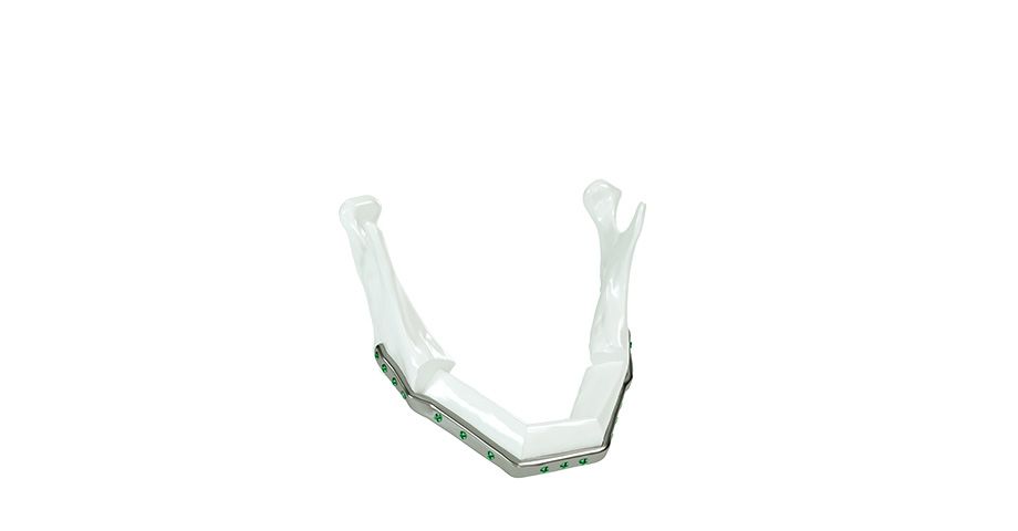 CMF surgery - Mandible