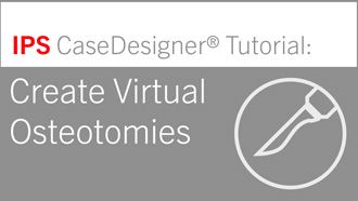 Workflow 5 – Create Virtual Osteotomies | IPS CaseDesigner® Tutorial