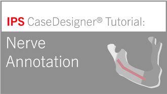 Workflow optional – Nerve Annotation | IPS CaseDesigner® Tutorial