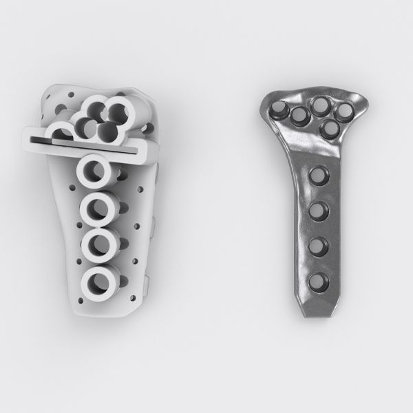 Noticias | ¿Cómo funciona el proceso de planificación en IPS Implants® Radius Reconstruction?