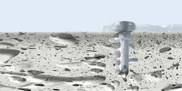 CMF surgery - SonicWeld Rx procedure 4