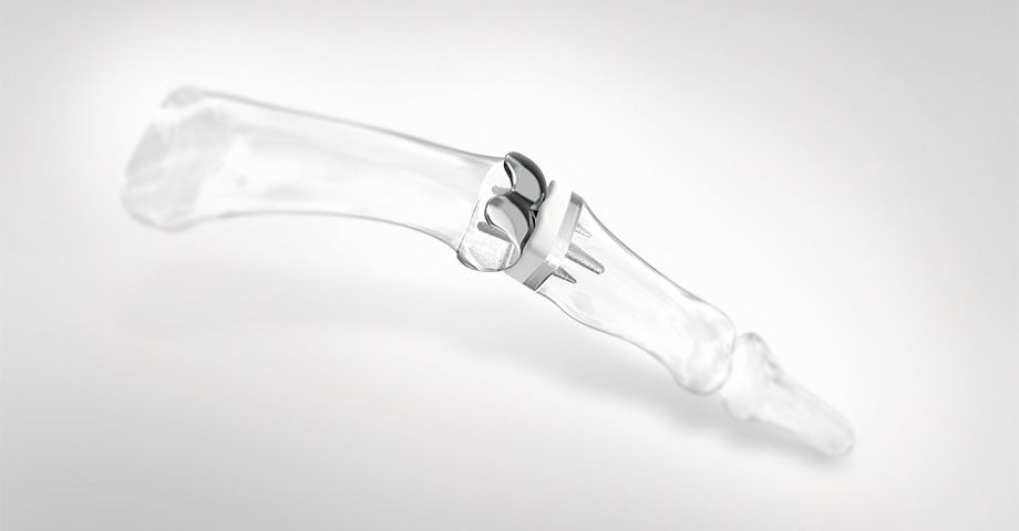 Handsurgery - Implants hand endoprosthetics CapFlex PIP