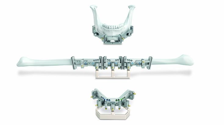 L1® Mandible ReconGuide 