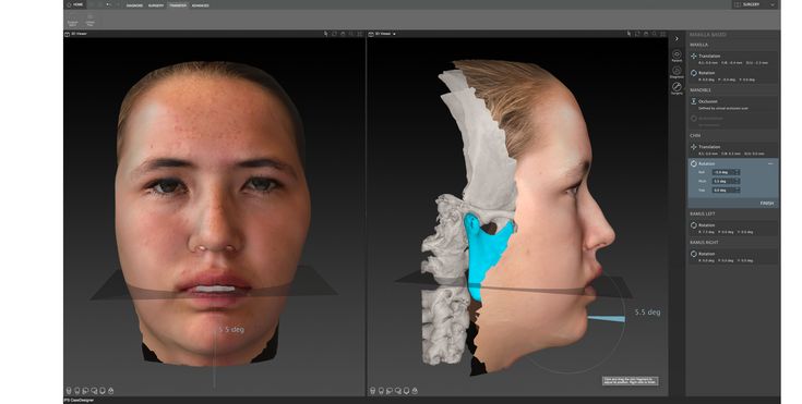 IPS CaseDesigner® - Estética