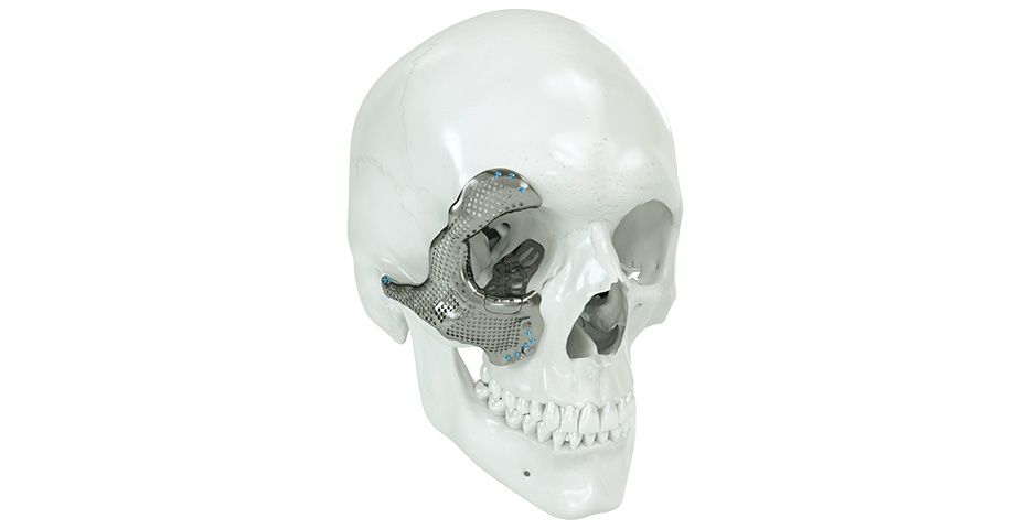 Cirugía cráneo-maxilofacial - medio facial