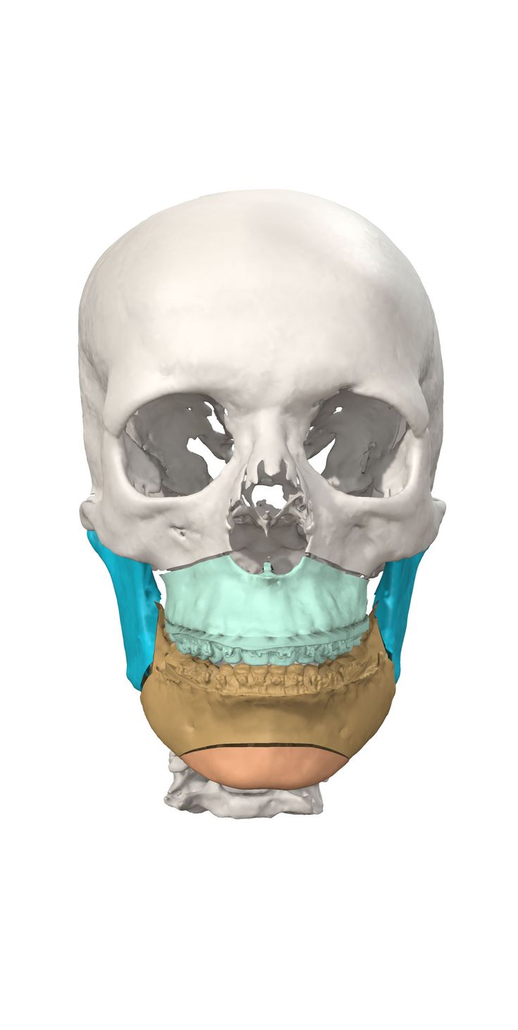 IPS CaseDesigner® - Indicaciones - características - beneficio