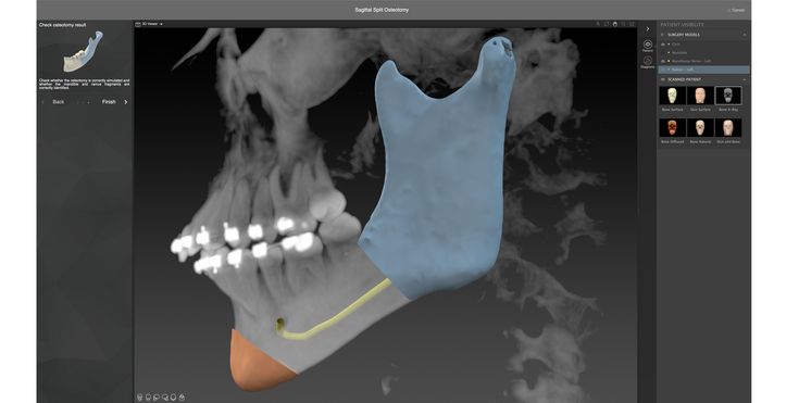 Individual Patient Solutions - Uniqueness