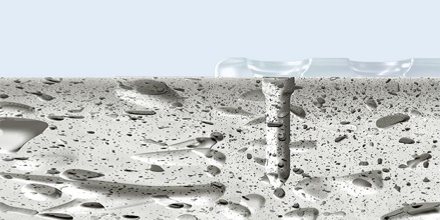 CMF surgery - SonicWeld Rx procedure 2