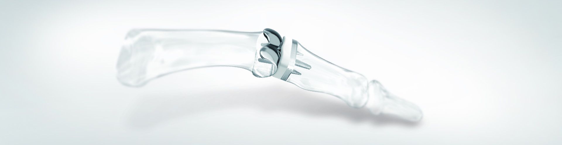 Implantes mano endoprotésica CapFlex PIP