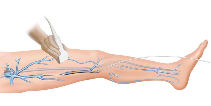 Chirurgische Lasersysteme