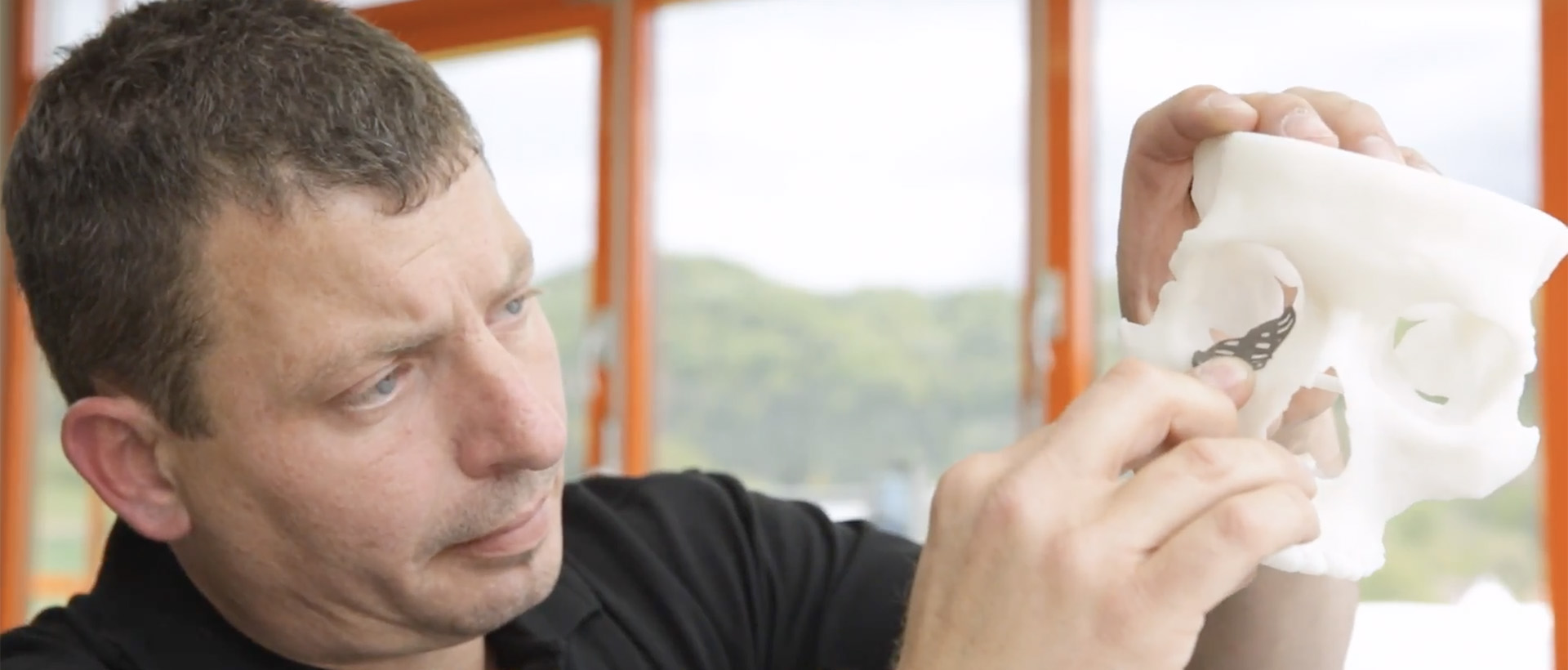 Individual Patient Solutions (IPS®) von der KLS Martin Group